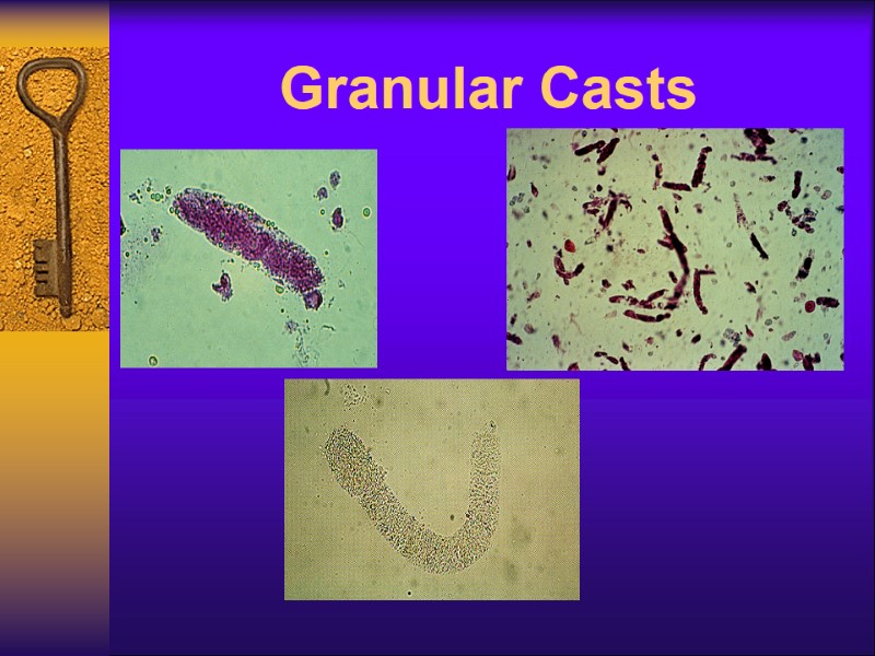 Granular Casts